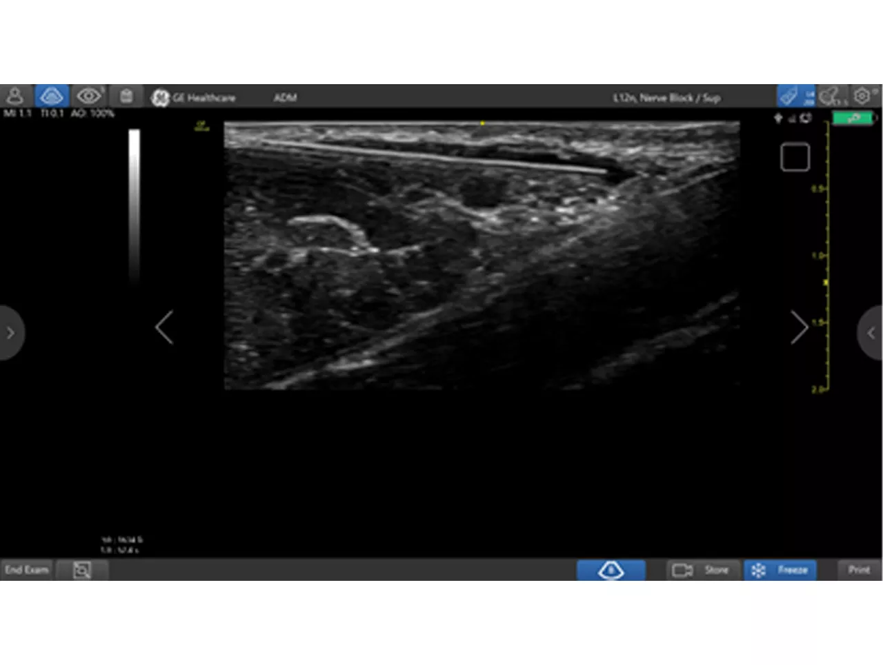 WebsiteAnaesthesiaThird component the S curveDesktop21300x980