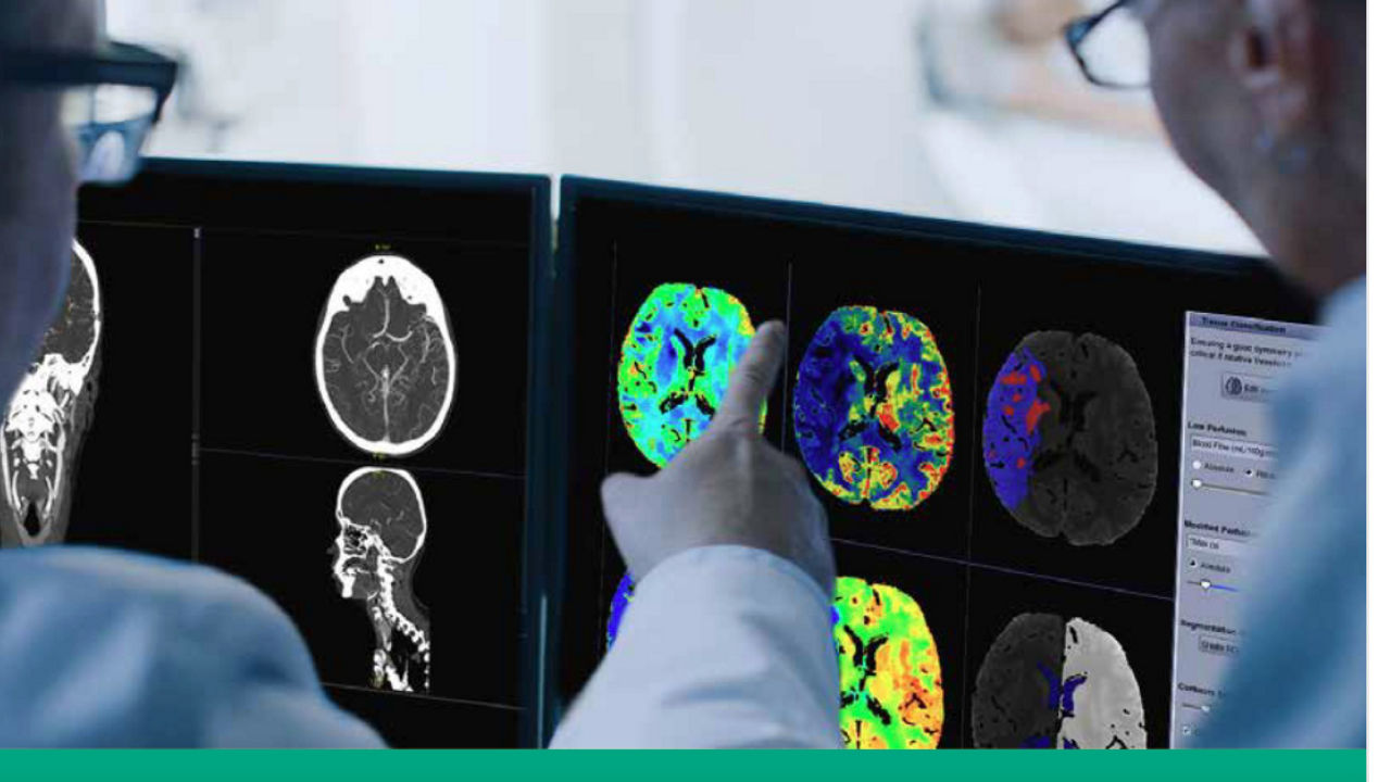 white-paper-tissue-segmentation-acute-ischemic-stroke-desktop