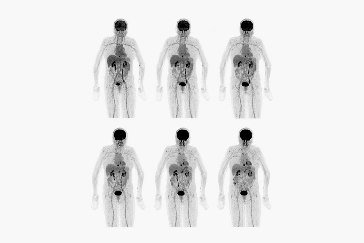 whole-body-iq-protocol