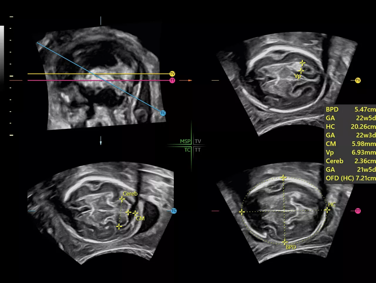 workflow-efficiency-clinical-image-of-sonocns-ci-en