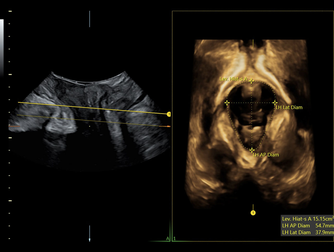 workflow-efficiency-sonopelvicfloor-ci-en