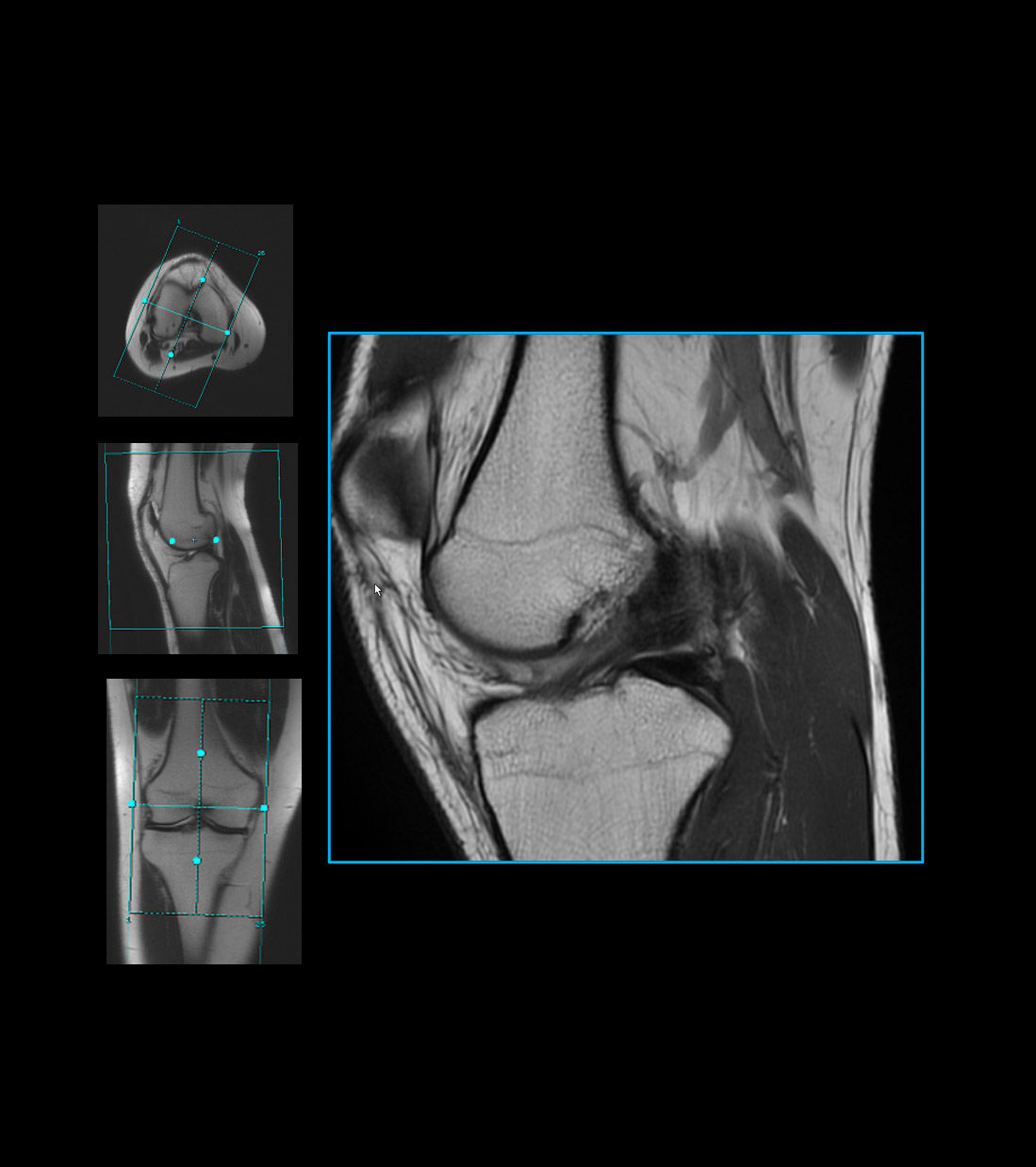 Workflow Feature card avoid repeat scans desktop