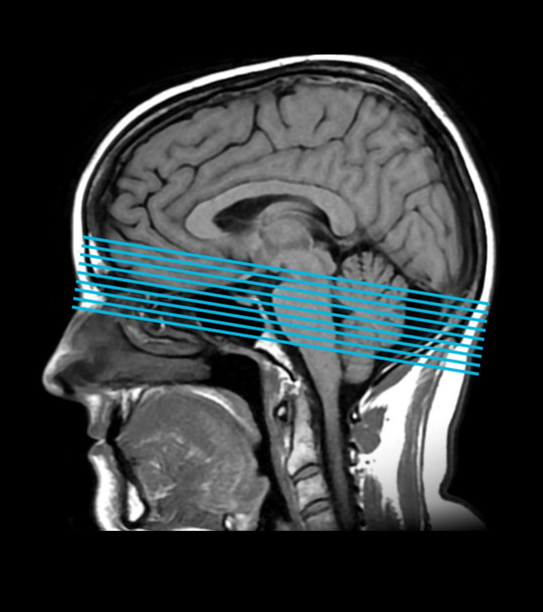 Workflow Feature card benefits desktop