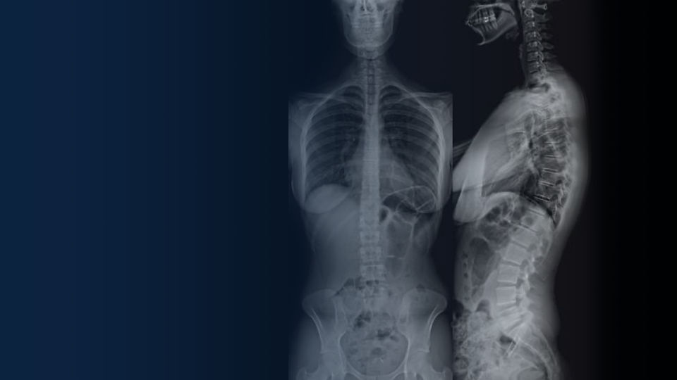 X-ray