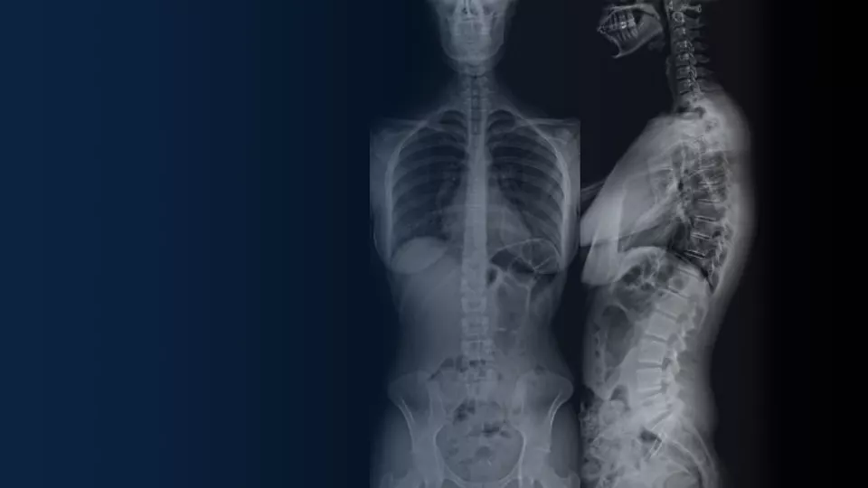 X-ray