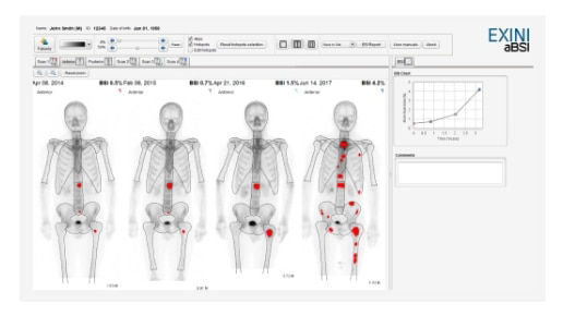 xeleris-v-molecular-exini-diagnostics-ab-ci-en