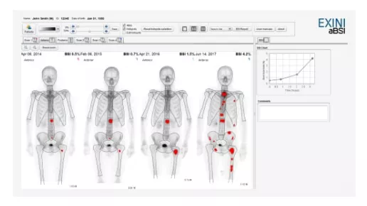 xeleris-v-molecular-exini-diagnostics-ab-ci-en