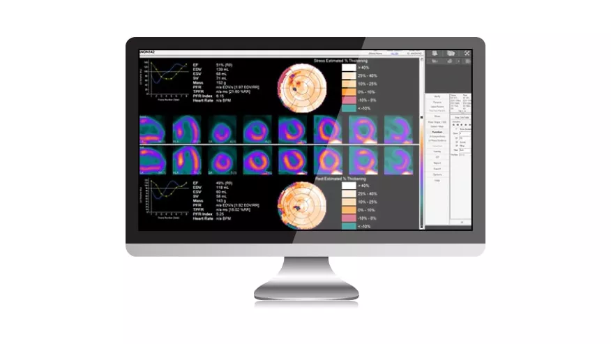 xeleris-v-molecular-syntermed-medical-imaging-ci-en