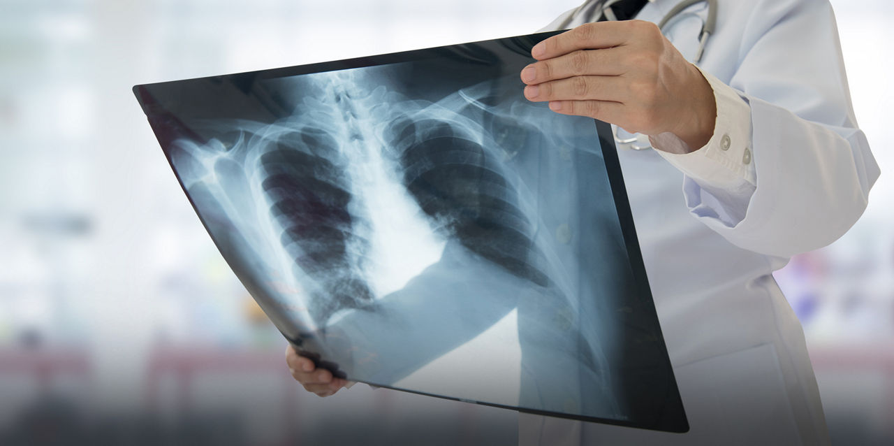 health professional holding x-ray