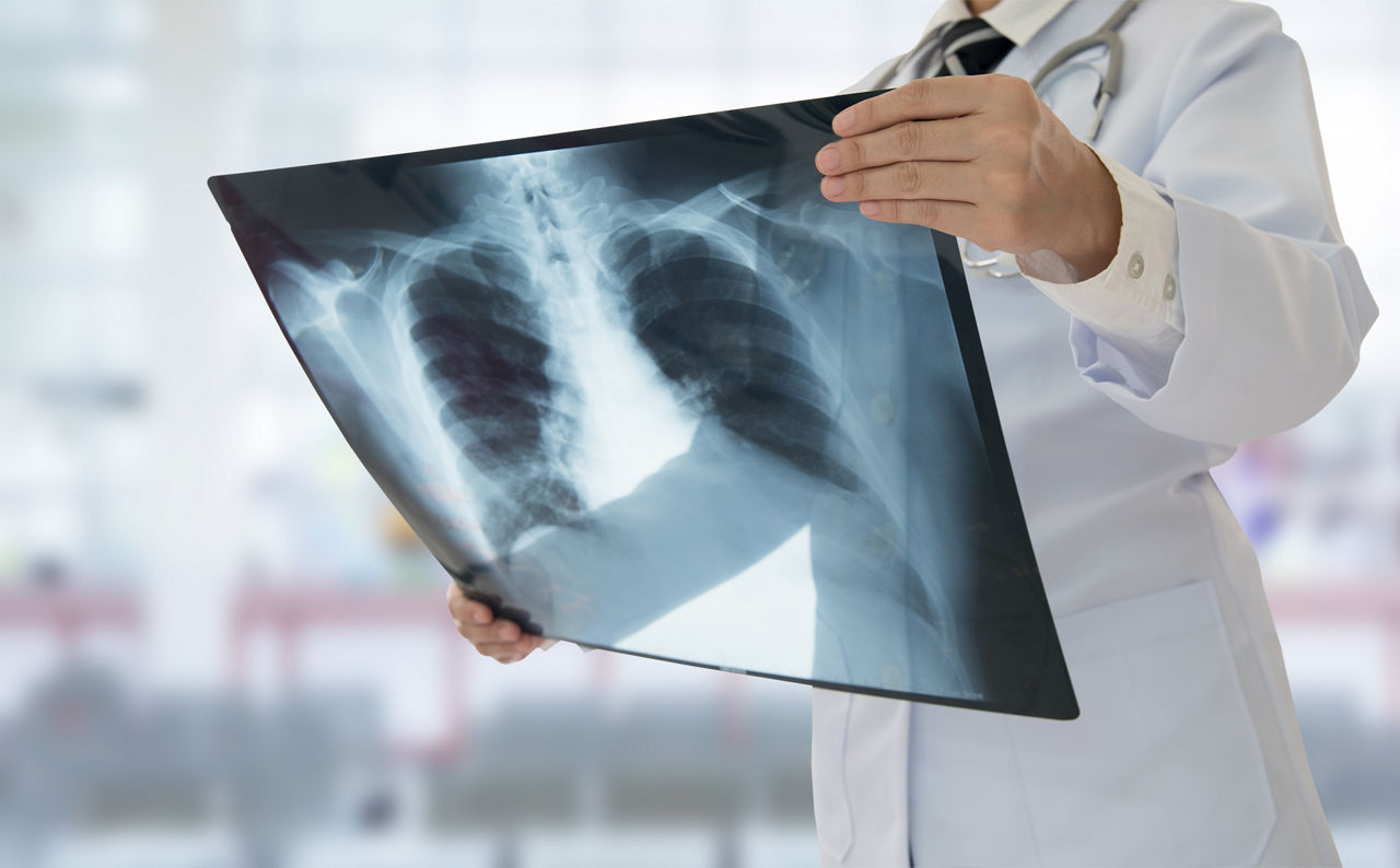 health professional holding xray