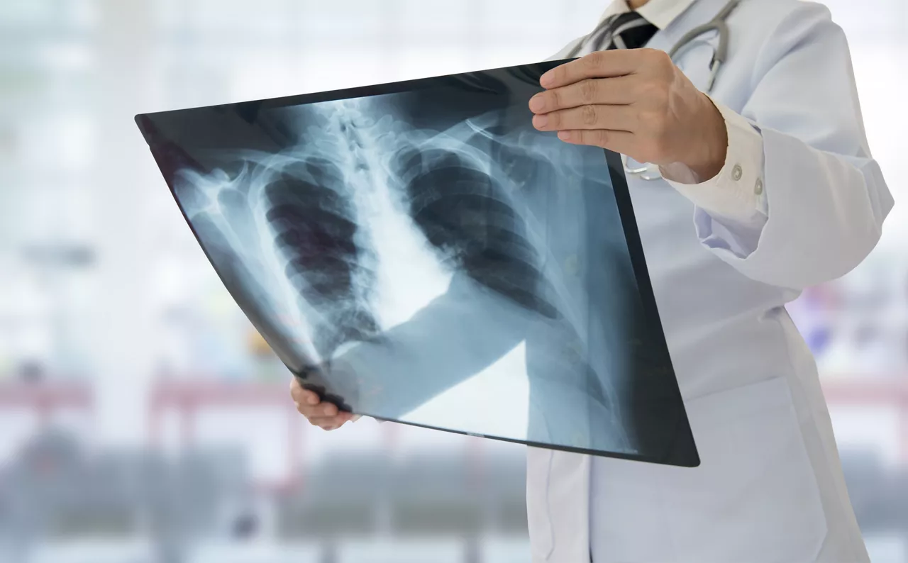 health professional holding xray