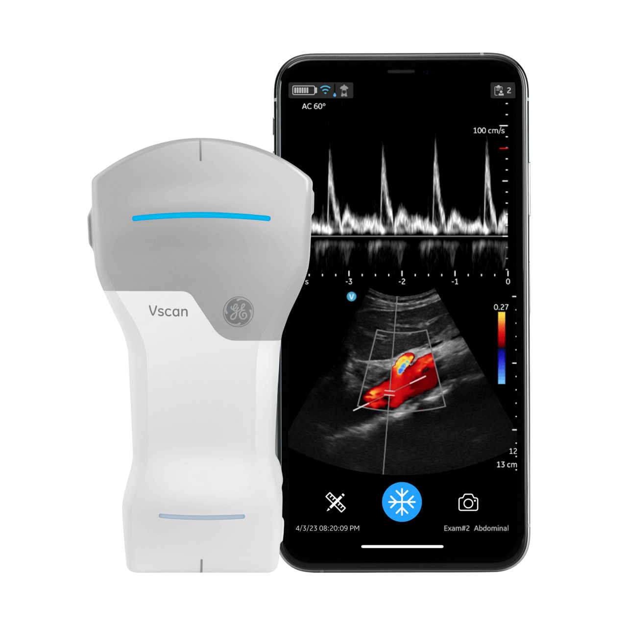 Vscan Extend Dual R2