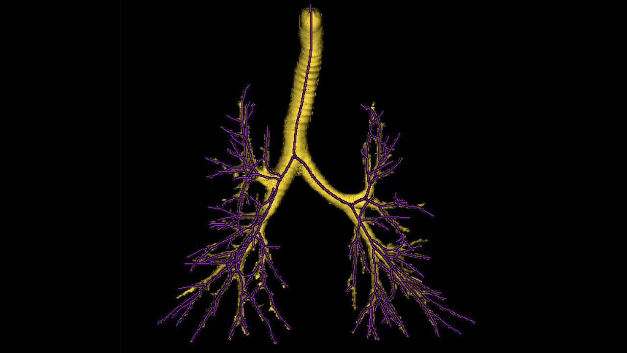 ation-applications-thoracic-vcar-image-gallery-aw-thoracic-vcar-trachea-lines-clinical