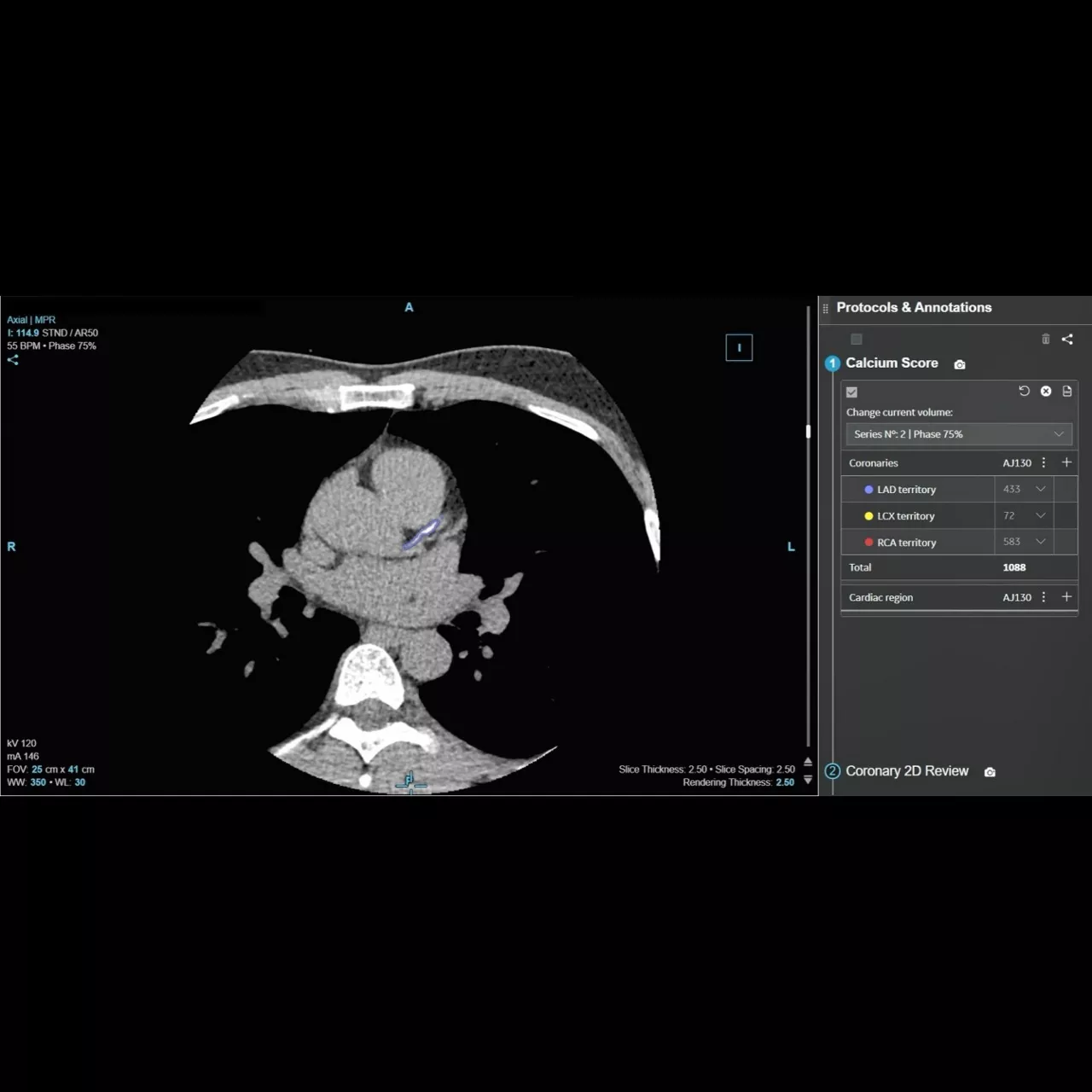 CardIQ Suite