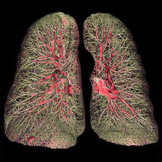 categories-computed-tomography-revolutionhd-gehc-revolution-hd-clinical-images-chest1