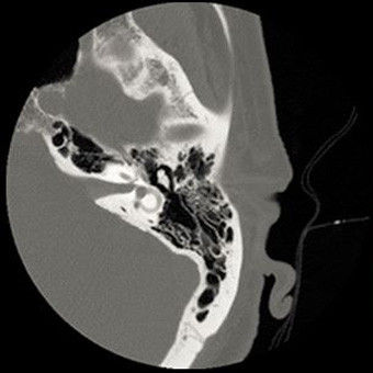 categories-computed-tomography-revolutionhd-gehc-revolution-hd-clinical-images-neuro2