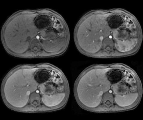 categories-ultrasound-signaarchitect-clinicalimages-paedworks-navigatedturbolava2