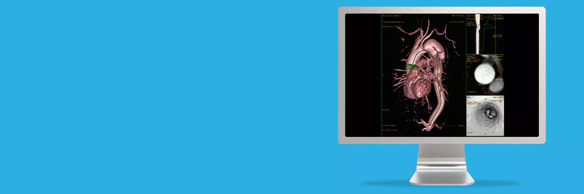 cloneadvancedvisualizationapplicationsmrvesseliqxpressawmrvesseliqspotlightjpg.jpg