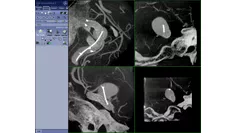 dvanced-visualization-applications-innova-ct-hd-clinical-ge-awinnovacthd-enterprise