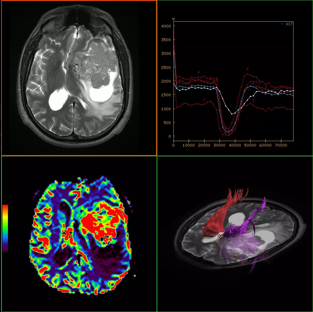 ed-visualization-applications-readyview-aw-readyview-clinical-image-multi-parametric2