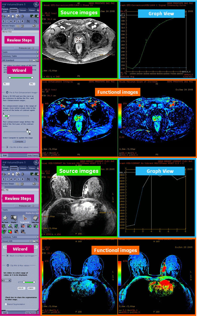 egories-do-not-clone-advanced-visualization-applications-bodyview-aw-bodyview_features.jpg