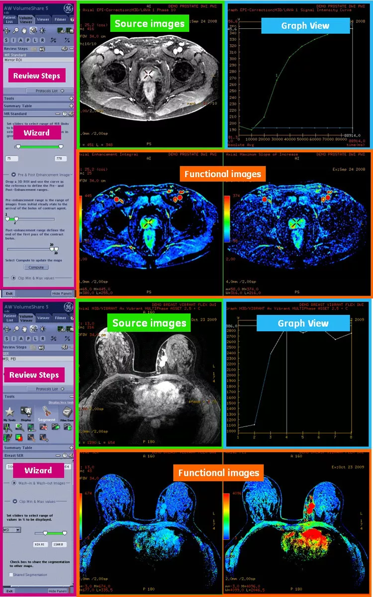 egories-do-not-clone-advanced-visualization-applications-bodyview-aw-bodyview_features.jpg