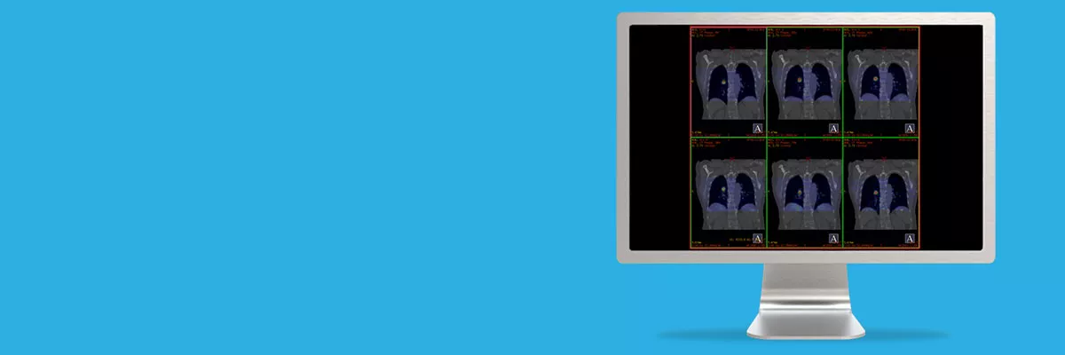 egories-do-not-clone-advanced-visualization-applications-motionvue-spotlight-motionvue.jpg