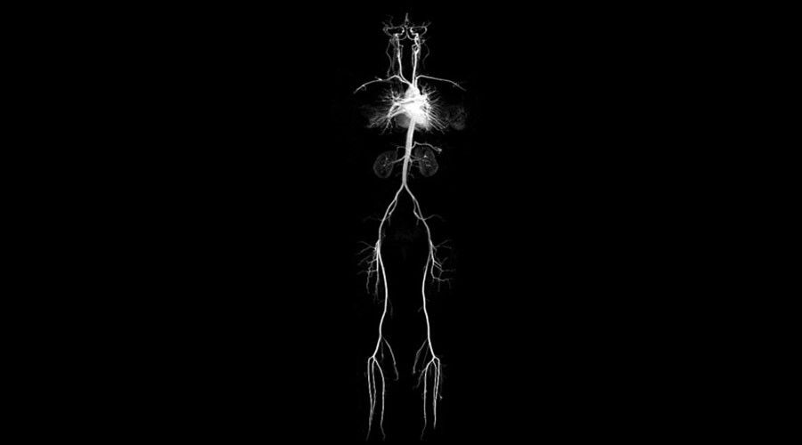 ge-ultrasound-signaarchitect-clinicalimages-cvworks-quickstep