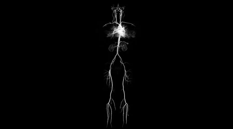 ge-product-categories-ultrasound-signa architect-clinical images-cvworks-quickstep.jpg