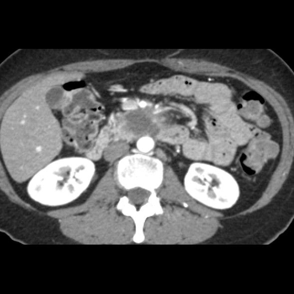 graphy-discoverygsi-imagegallery-body-gehc-revolution-gsi-clinical-image-body2-71kev