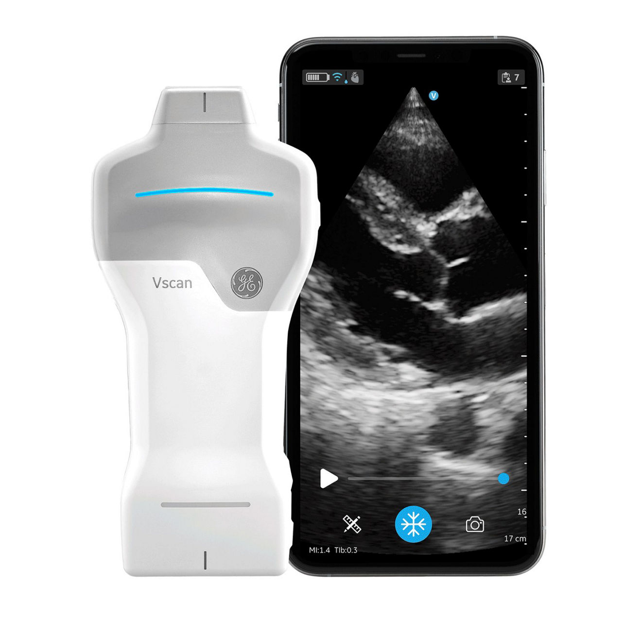 Ultrasonido portátil: Vscan Air™ SL