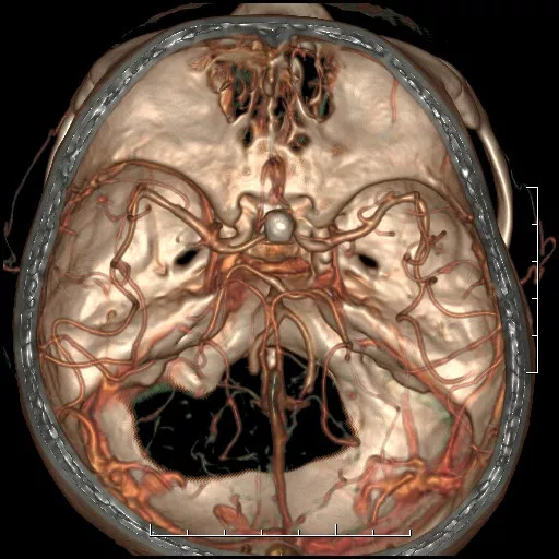 ies-computed-tomography-discoverygsi-imagegallery-neuro-revolution-gsi-neuro-image17