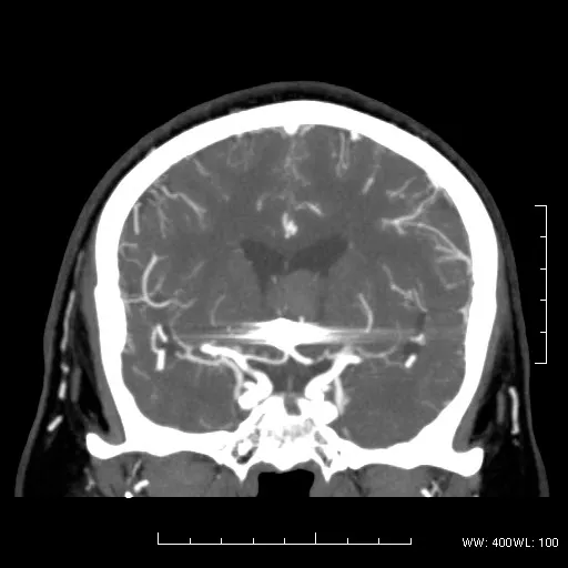 ies-computed-tomography-discoverygsi-imagegallery-neuro-revolution-gsi-neuro-image19
