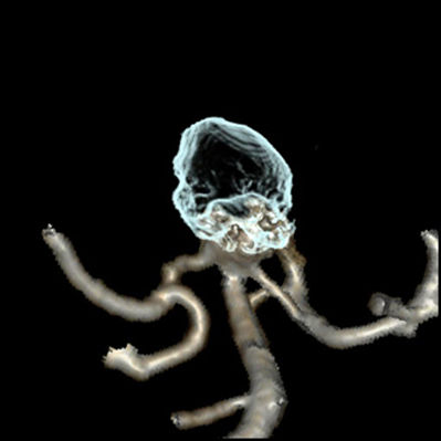 ies-computed-tomography-discoverygsi-imagegallery-neuro-revolution-gsi-neuro-image24