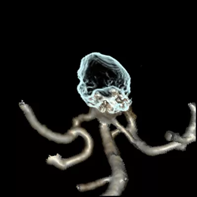 ies-computed-tomography-discoverygsi-imagegallery-neuro-revolution-gsi-neuro-image24