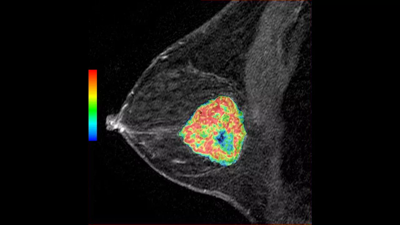 o-not-clone-advanced-visualization-applications-bodyview-aw-bodyview-clinical-images-2