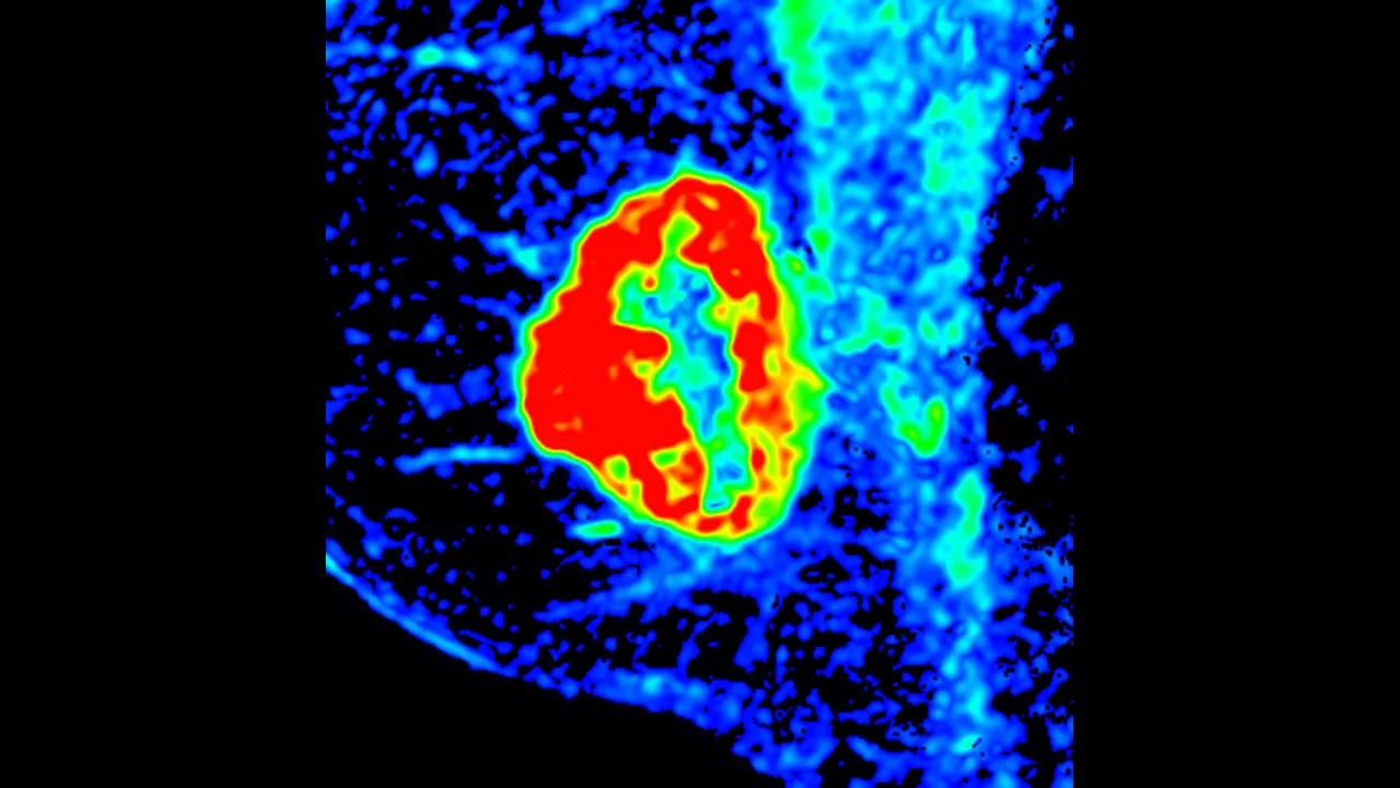 o-not-clone-advanced-visualization-applications-bodyview-aw-bodyview-clinical-images-3