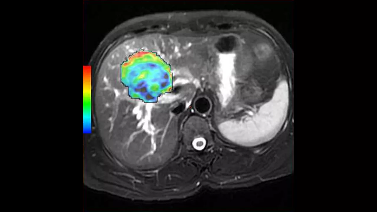o-not-clone-advanced-visualization-applications-bodyview-aw-bodyview-clinical-images-4