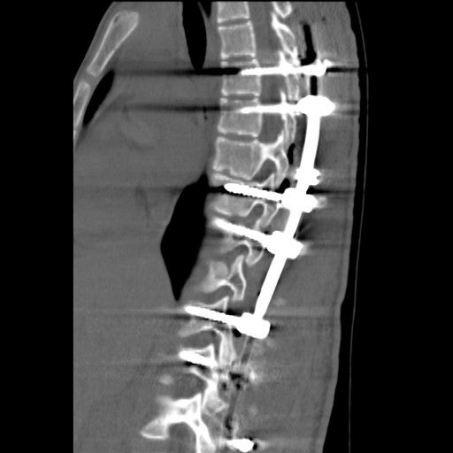 omography-discoverygsi-imagegallery-musculoskeletal-revolution-gsi-msk-image46-thumb