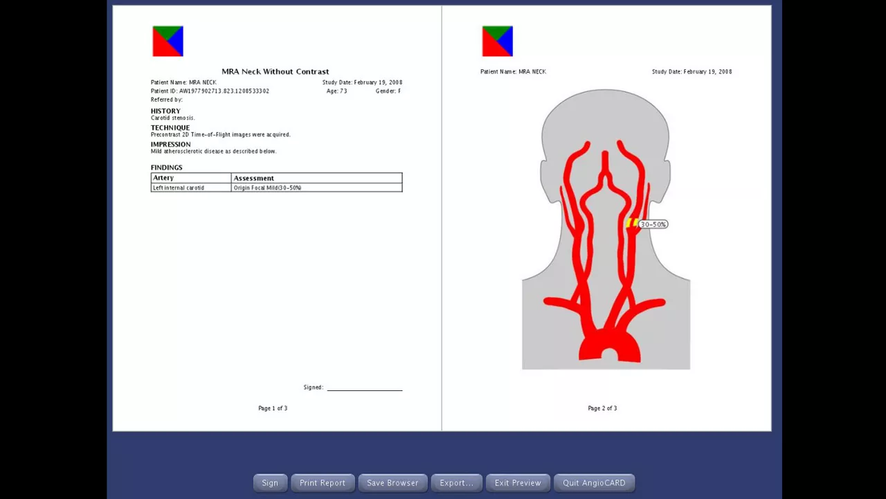 one-advanced-visualization-applications-angiocard-image-gallery-aw-angiocard-clinical2