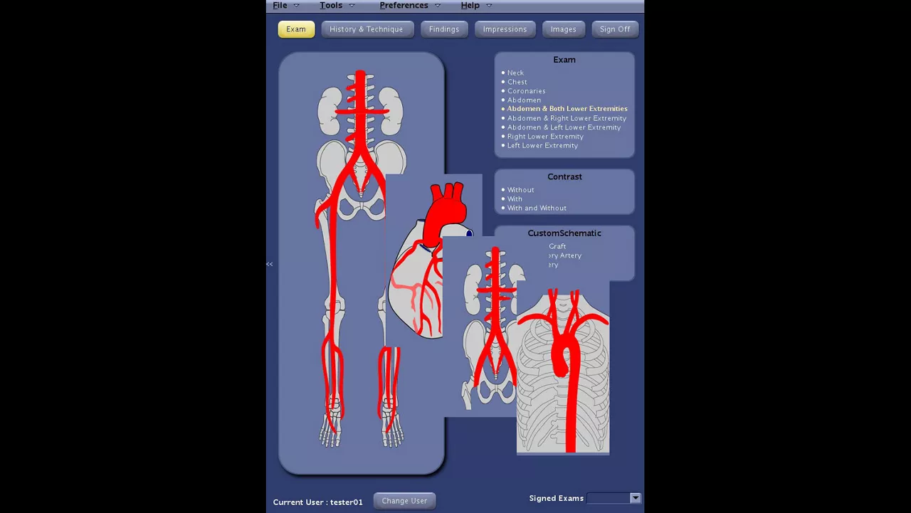 one-advanced-visualization-applications-angiocard-image-gallery-aw-angiocard-clinical3