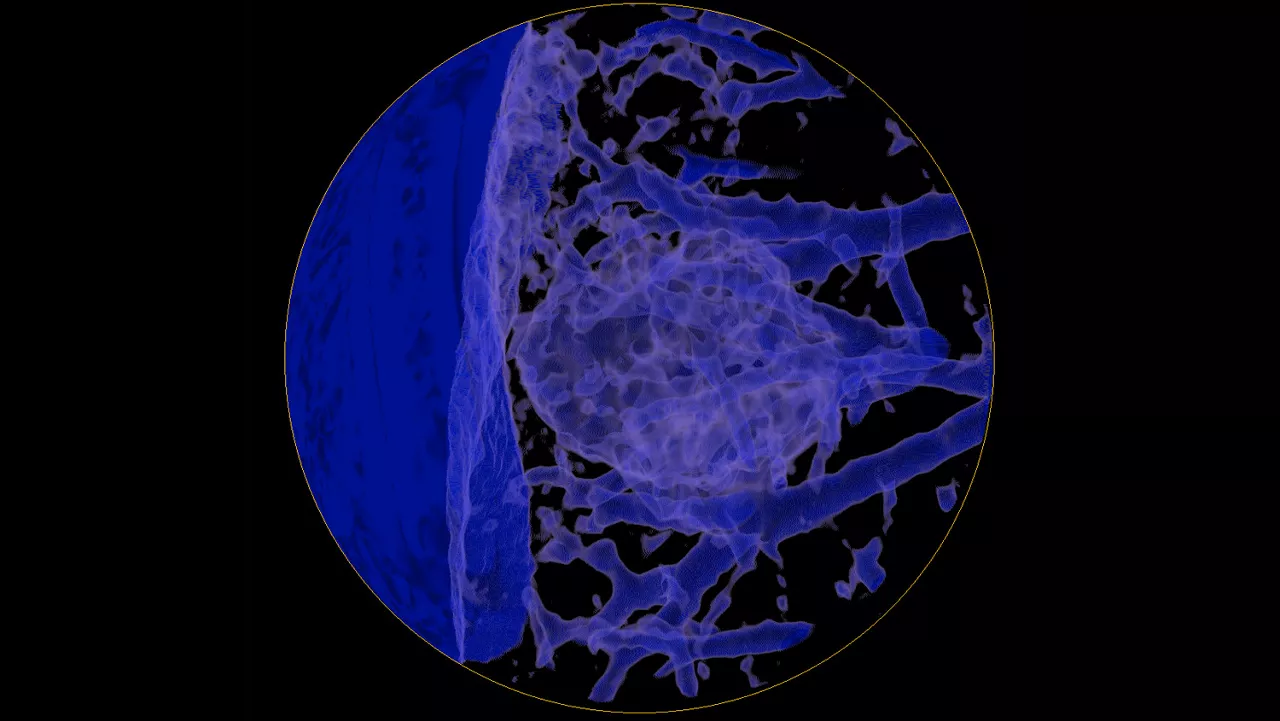 one-advanced-visualization-applications-lung-vcar-image-gallery-aw-lung-vcar-clinical4