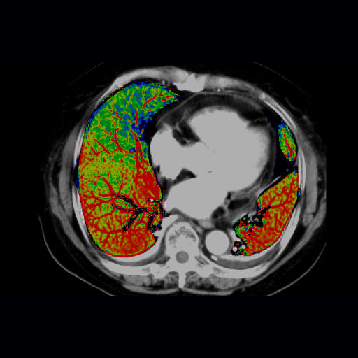 ories-computed-tomography-discoverygsi-imagegallery-body-revolution-gsi-body-image25