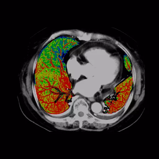 ories-computed-tomography-discoverygsi-imagegallery-body-revolution-gsi-body-image25