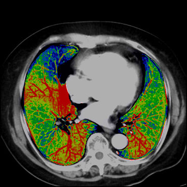 ories-computed-tomography-discoverygsi-imagegallery-body-revolution-gsi-body-image26