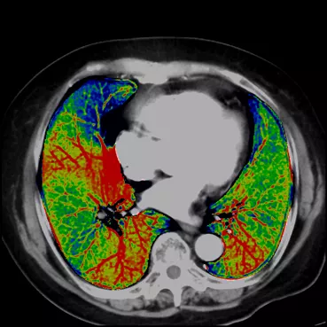 ories-computed-tomography-discoverygsi-imagegallery-body-revolution-gsi-body-image26
