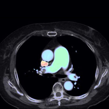 ories-computed-tomography-discoverygsi-imagegallery-body-revolution-gsi-body-image27