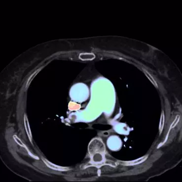 ories-computed-tomography-discoverygsi-imagegallery-body-revolution-gsi-body-image27