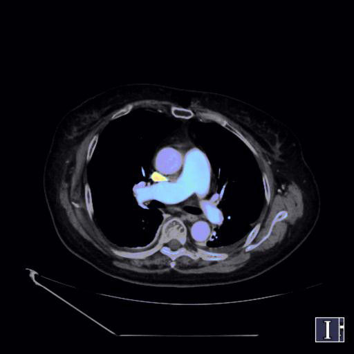 ories-computed-tomography-discoverygsi-imagegallery-body-revolution-gsi-body-image28