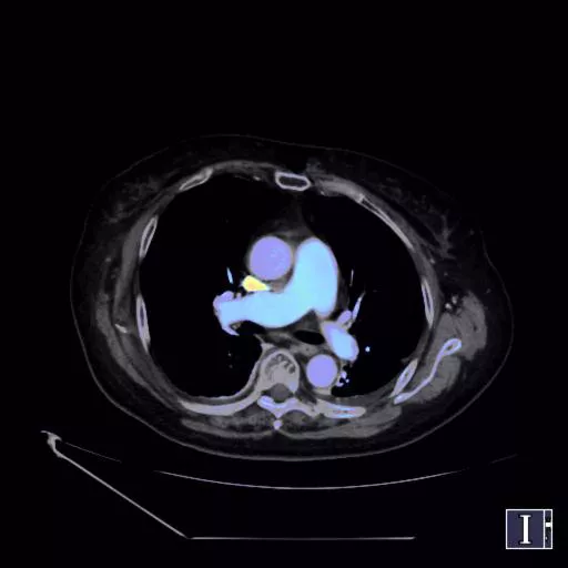 ories-computed-tomography-discoverygsi-imagegallery-body-revolution-gsi-body-image28
